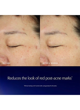 Advanced Night Repair Recovery Treatment Essence/Treatment Lotion